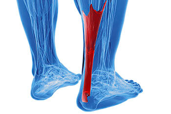 Achilles tendinitis treatment in the Wayne County, MI: Detroit (Cornerstone Village, Conner Creek, Midtown, Grosse Pointe, Mexicantown, Harper Woods, Jefferson Chalmers, Springwells, Delray), West Detroit (Livonia, Westland, Redford Charter Twp, Inkster, Allen Park, Ecorse, Farmington, Southfield, Garden City), Northwest Detroit, Hamtramck (North End, Highland Park, Osborn, Islandview, Eastern Market, Corktown, Schulze, Eastpointe, Roseville), and Dearborn Heights (Canton, Romulus, Plymouth, Brightmoor), and Macomb County, MI: Sterling Heights (Madison Heights, Warren, Clawson, Center Line, Berkley, Royal Oak, Fitzgerald, Fraser, Birmingham, Lathrup Village) areas