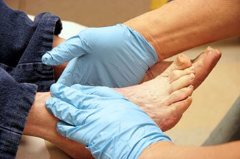 Diabetic foot treatment in the Wayne County, MI: Detroit (Cornerstone Village, Conner Creek, Midtown, Grosse Pointe, Mexicantown, Harper Woods, Jefferson Chalmers, Springwells, Delray), West Detroit (Livonia, Westland, Redford Charter Twp, Inkster, Allen Park, Ecorse, Farmington, Southfield, Garden City), Northwest Detroit, Hamtramck (North End, Highland Park, Osborn, Islandview, Eastern Market, Corktown, Schulze, Eastpointe, Roseville), and Dearborn Heights (Canton, Romulus, Plymouth, Brightmoor), and Macomb County, MI: Sterling Heights (Madison Heights, Warren, Clawson, Center Line, Berkley, Royal Oak, Fitzgerald, Fraser, Birmingham, Lathrup Village) areas