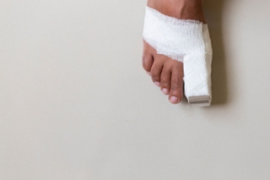 Managing a Broken Toe