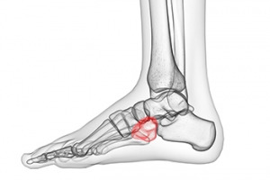 Where Is the Cuboid Bone?