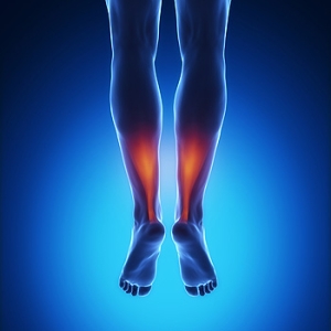 Symptoms of an Achilles Tendon Rupture