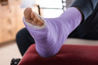 Treatment Options for Stress Fractures