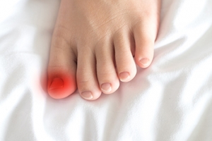 Relief and Prevention Methods for Ingrown Toenails