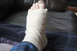 How to Manage a Broken Foot