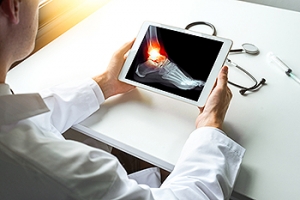 How Long Do I Wear a Boot or Cast for My Broken Foot?