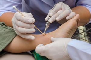 Treatment Options for Foot Ulcers